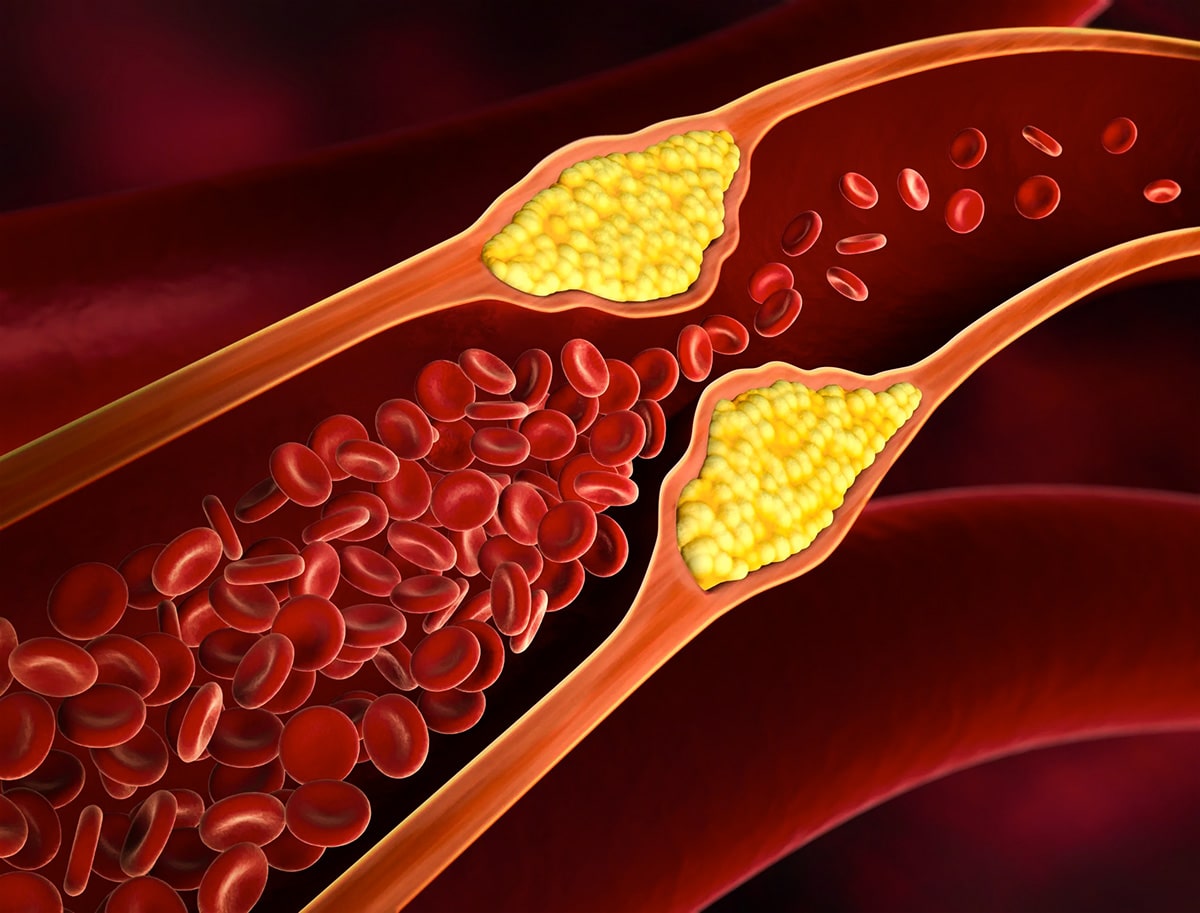 La interacción de un gen y el colesterol provoca la tolerancia a los opiáceos 
